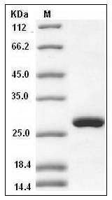 Human RPE / RPE2-1 Protein (His Tag) SDS-PAGE