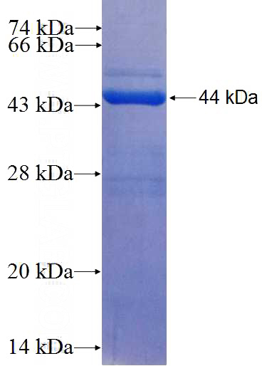 Recombinant Human GEM SDS-PAGE