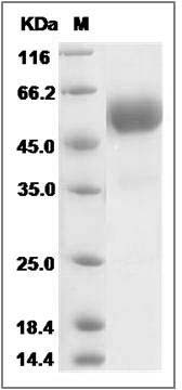 Human TMEM27 Protein (Fc Tag) SDS-PAGE