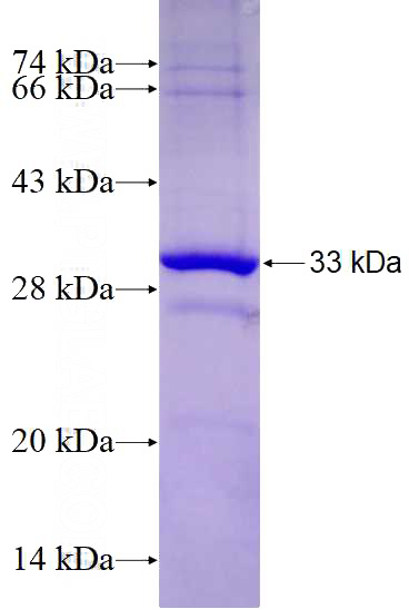 Recombinant Human XRRA1 SDS-PAGE
