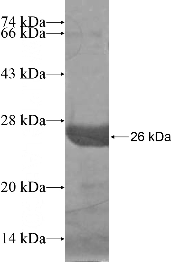 Recombinant Human CPEB2 SDS-PAGE