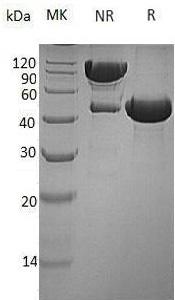 Human CTSE (His tag) recombinant protein
