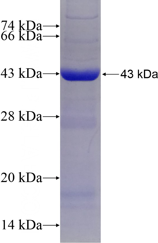 Recombinant Human NAGLU SDS-PAGE
