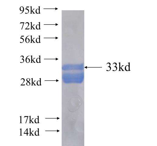 Recombinant human ZNF253 SDS-PAGE