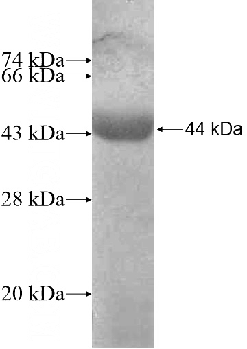 Recombinant Human KATNAL2 SDS-PAGE