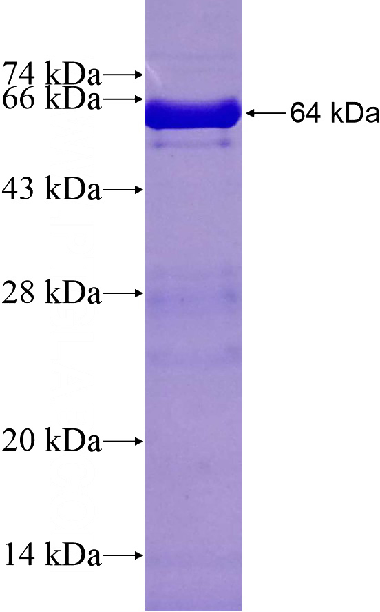 Recombinant Human ZNF326 SDS-PAGE