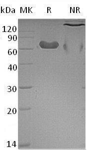 Mouse Ltbr/Tnfcr/Tnfrsf3 (Fc tag) recombinant protein