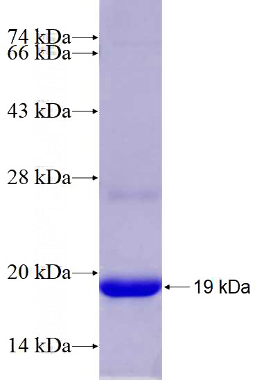 Recombinant Human IL-11RA SDS-PAGE