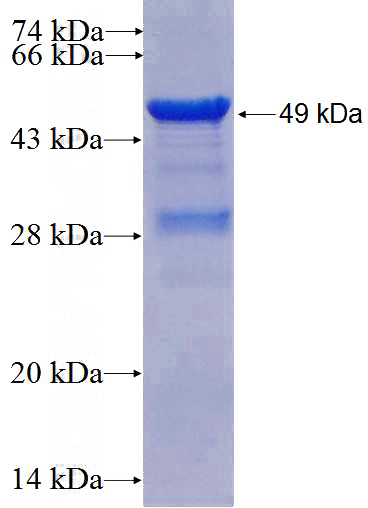 Recombinant Human RALB SDS-PAGE