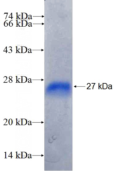 Recombinant Human ABCB8 SDS-PAGE