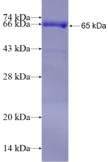 Recombinant Human DDX46 SDS-PAGE