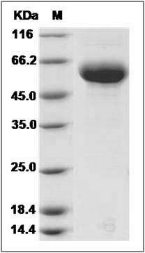 Cynomolgus DDR2 Kinase / CD167b Protein (His Tag) SDS-PAGE