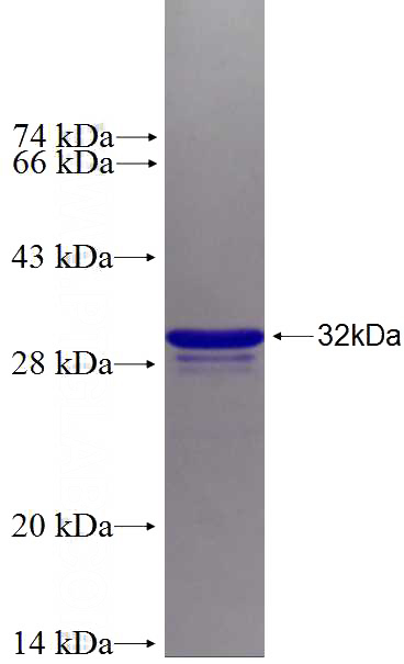 Recombinant Human ABI3BP SDS-PAGE