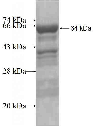 Recombinant Human CTNNA2 SDS-PAGE