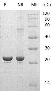 Human HSPB8/CRYAC/E2IG1/HSP22/PP1629 (His tag) recombinant protein