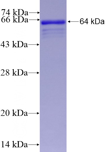 Recombinant Human ZHX2 SDS-PAGE