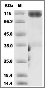 Human MAG / GMA / Siglec-4 Protein (Fc Tag) SDS-PAGE