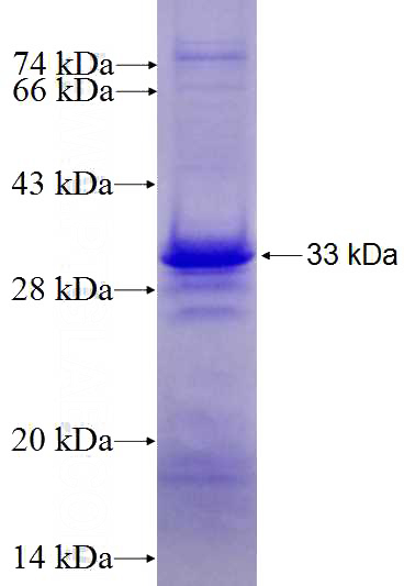Recombinant Human UGCGL2 SDS-PAGE