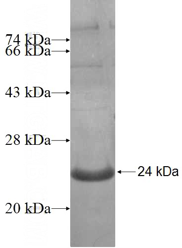 Recombinant Human HBXIP SDS-PAGE