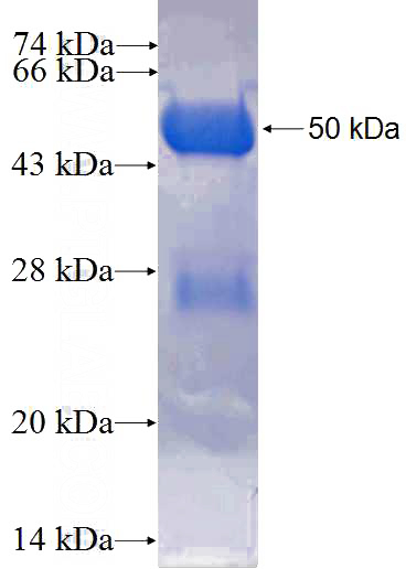 Recombinant Human ARHGAP29 SDS-PAGE