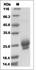 CTLA4 protein SDS-PAGE
