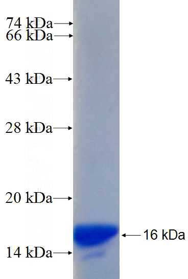 Recombinant Human RANBP2 SDS-PAGE