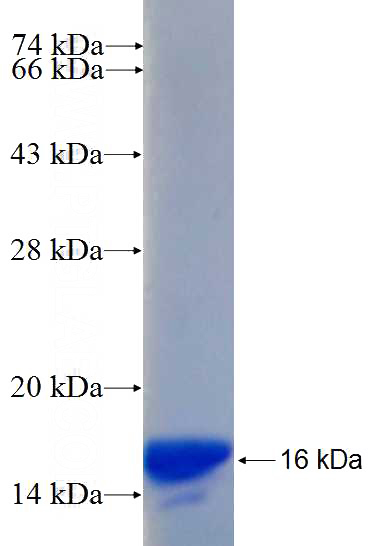 Human RANBP2 Recombinant protein (6*His tag)