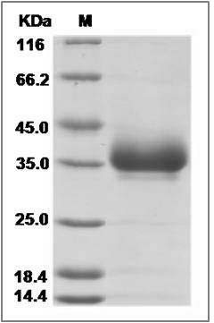 Cynomolgus CD2 Protein (His Tag) SDS-PAGE