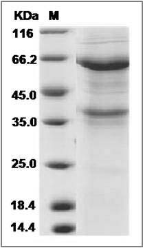 Canine ANGPTL1 / Angiopoietin-like 1 Protein (Fc Tag) SDS-PAGE