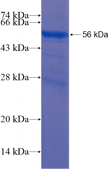 Recombinant Human LONRF2 SDS-PAGE