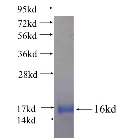 Recombinant human HELZ SDS-PAGE