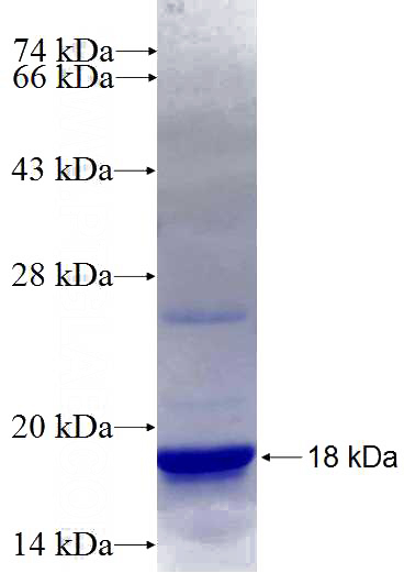 Recombinant Human MTMR1 SDS-PAGE