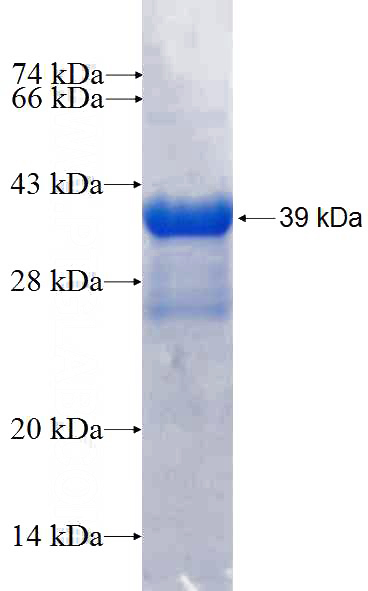 Recombinant Human TRO SDS-PAGE