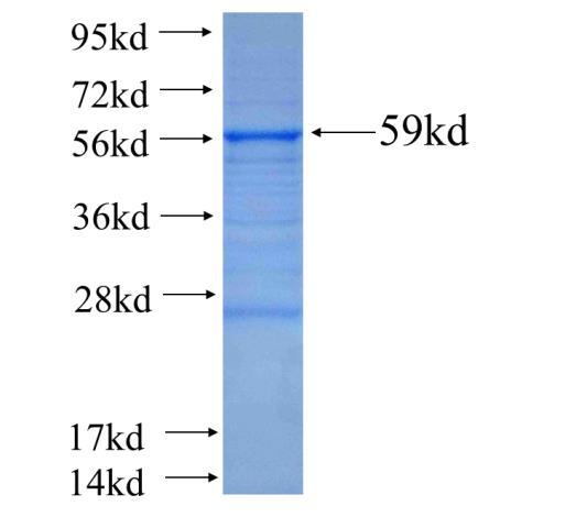 Recombinant human MACF1 SDS-PAGE