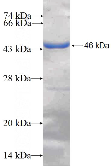 Recombinant Human RGS8 SDS-PAGE