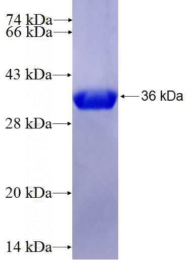 Recombinant Human CKS1B SDS-PAGE