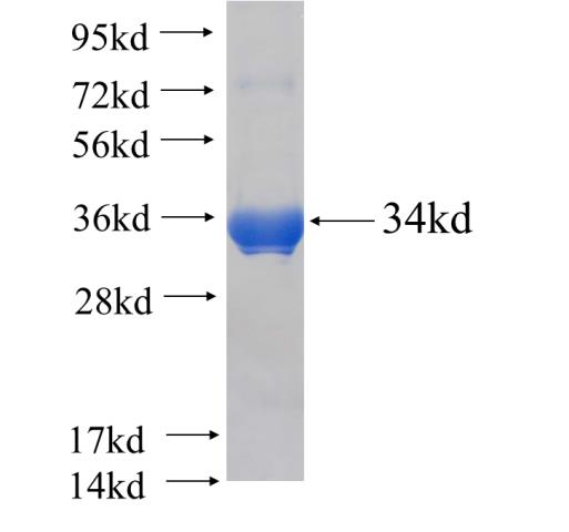 Recombinant human MAGEC2 SDS-PAGE