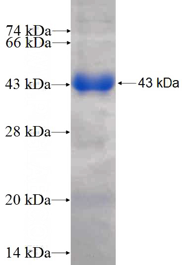 Recombinant Human LPCAT1 SDS-PAGE