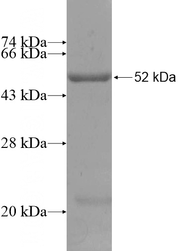 Recombinant Human APOBEC2 SDS-PAGE