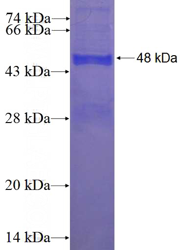 Recombinant Human FAHD1 SDS-PAGE