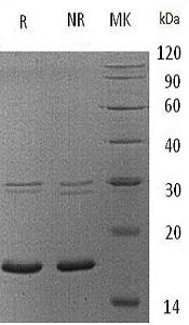 Human UBE2B/RAD6B (His tag) recombinant protein