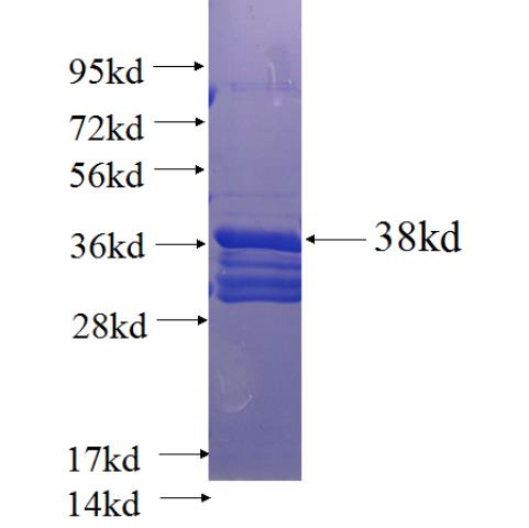 Recombinant human ZC3H12B SDS-PAGE