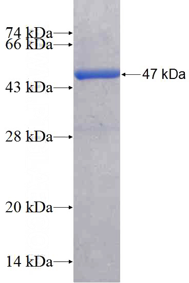 Recombinant Human RAP1B SDS-PAGE