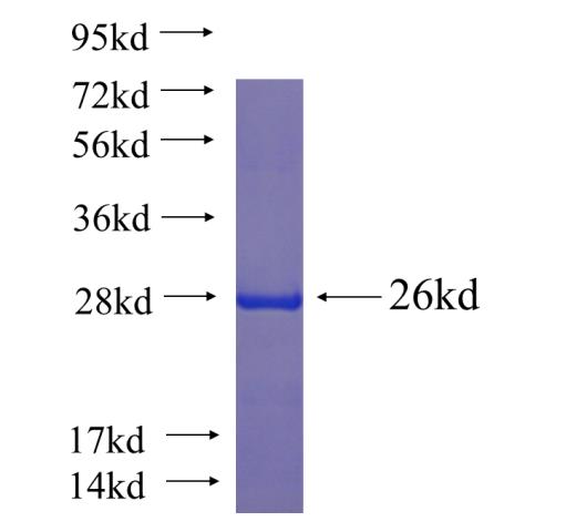 Recombinant human MARVELD3 SDS-PAGE