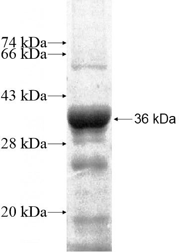 Recombinant Human FCRLB SDS-PAGE