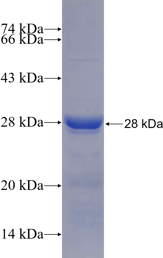 Recombinant Human SLC30A6 SDS-PAGE