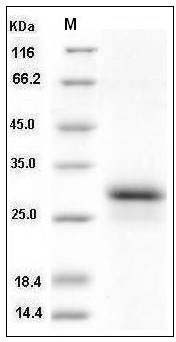 Human CD8A / MAL Protein (His Tag) SDS-PAGE