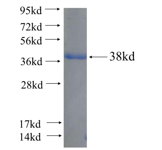 Recombinant human RAPGEFL1 SDS-PAGE