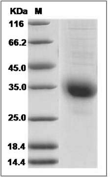 Human CGB5 Protein (His Tag) SDS-PAGE