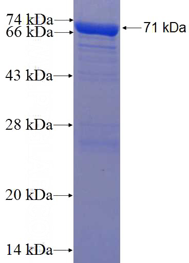 Recombinant Human RBMS1 SDS-PAGE